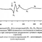 Method of indirect irritation or indirect stimulation of the cortex