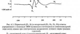 Метод непрямого раздражения или непрямой стимуляции коры