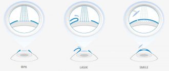 The difference between lasik and femtolasik